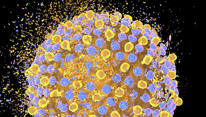 Ending hepatitis – The discovery of HCV