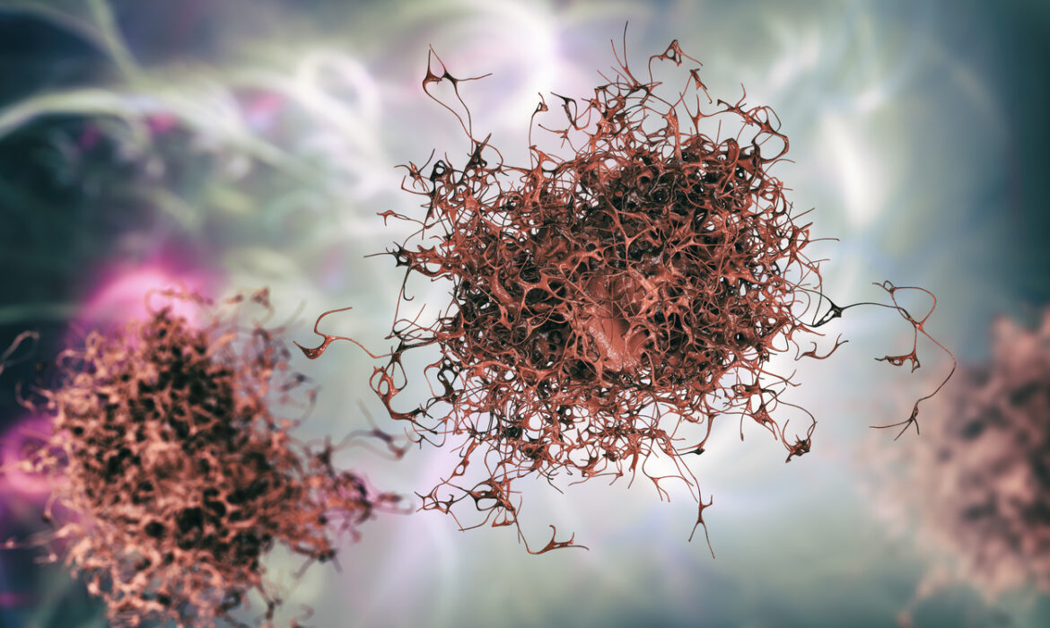 cancer cell istock