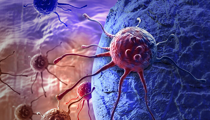 Researchers find new way to kill cancer cells