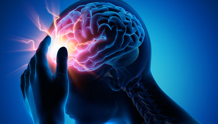 Study reveals new genetic risk factors for migraine